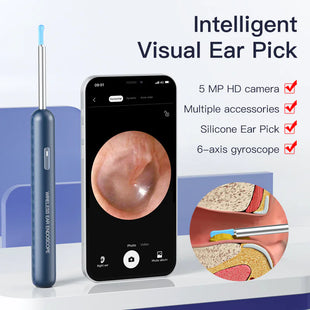 EarScope Wireless Endo-Cleaner